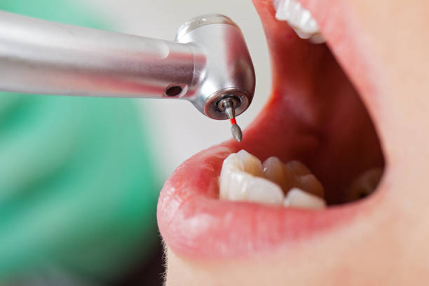 Best Emergency Treatment for Oral Infections in Farmingville, NY
